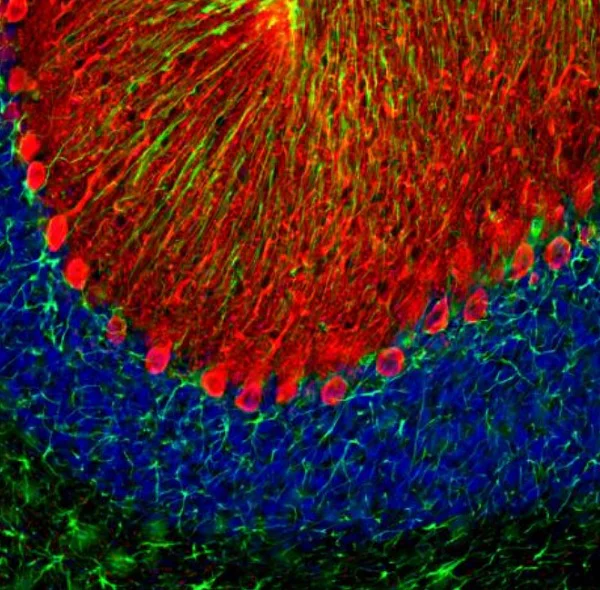 Immunocytochemistry/ Immunofluorescence - Anti-GFAP antibody - Astrocyte Marker (AB254082)