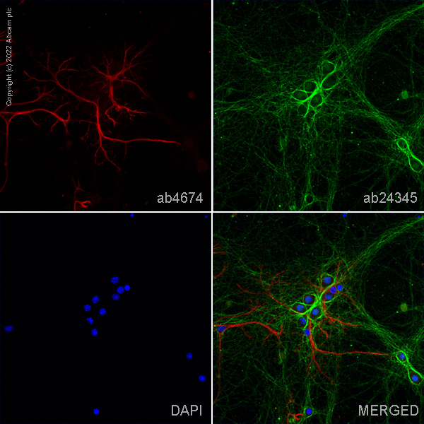 Immunocytochemistry/ Immunofluorescence - Anti-GFAP antibody (AB4674), expandable thumbnail