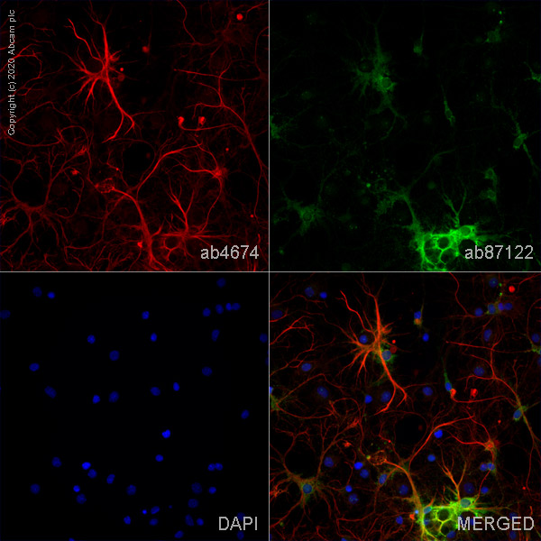 Immunocytochemistry/ Immunofluorescence - Anti-GFAP antibody (AB4674), expandable thumbnail
