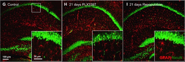 Immunohistochemistry (Formalin/PFA-fixed paraffin-embedded sections) - Anti-GFAP antibody (AB4674), expandable thumbnail
