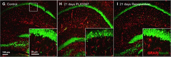 Immunohistochemistry (Formalin/PFA-fixed paraffin-embedded sections) - Anti-GFAP antibody - Astrocyte Marker (AB4674)