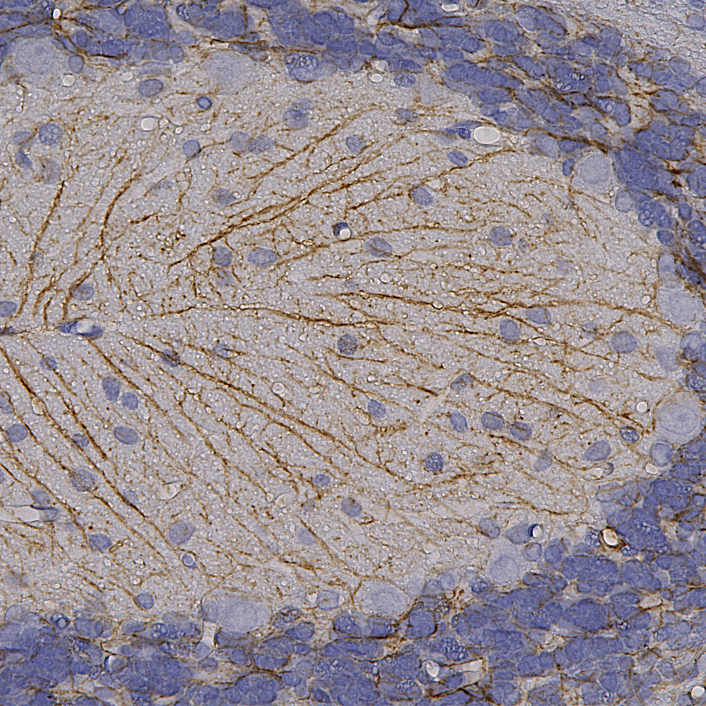 Immunohistochemistry (Formalin/PFA-fixed paraffin-embedded sections) - Anti-GFAP antibody (ab4674), expandable thumbnail