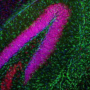 Immunohistochemistry - Free Floating - Anti-GFAP antibody (AB4674), expandable thumbnail