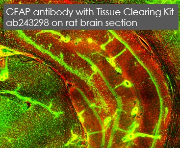 Immunohistochemistry (PFA fixed) - Anti-GFAP antibody (AB4674), expandable thumbnail