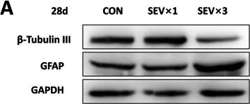 Anti-GFAP (Glial Fibrillary Acidic Protein) antibody (ab53554) | Abcam