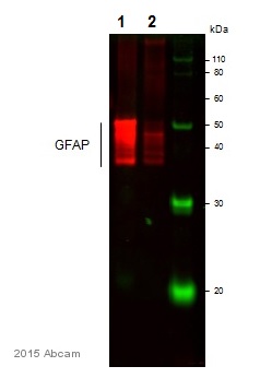Western blot - Anti-GFAP antibody - Astrocyte Marker (AB53554), expandable thumbnail
