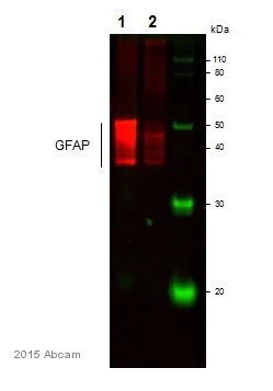 Western blot - Anti-GFAP antibody - Astrocyte Marker (AB53554)