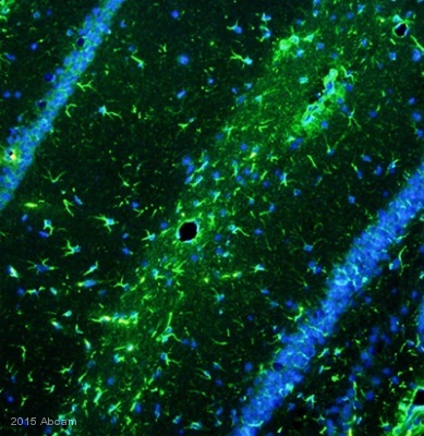 Immunocytochemistry/ Immunofluorescence - Anti-GFAP antibody - Astrocyte Marker (ab7260), expandable thumbnail