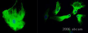 Immunocytochemistry/ Immunofluorescence - Anti-GFAP antibody - Astrocyte Marker (AB7260), expandable thumbnail