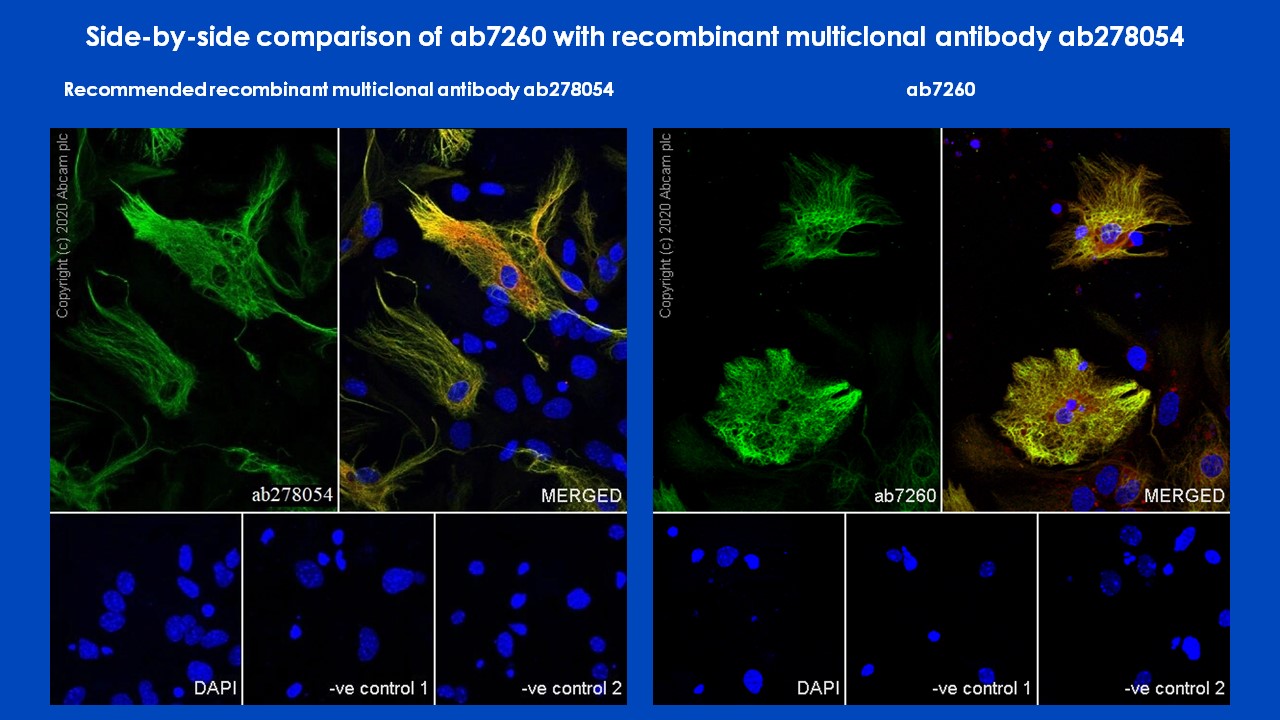 Immunocytochemistry/ Immunofluorescence - Anti-GFAP antibody - Astrocyte Marker (ab7260), expandable thumbnail