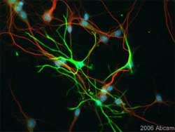 Immunocytochemistry/ Immunofluorescence - Anti-GFAP antibody - Astrocyte Marker (AB7260), expandable thumbnail