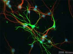 Immunocytochemistry/ Immunofluorescence - Anti-GFAP antibody - Astrocyte Marker (AB7260)