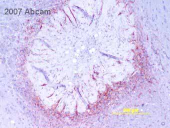 Immunohistochemistry (Formalin/PFA-fixed paraffin-embedded sections) - Anti-GFAP antibody (ab7260), expandable thumbnail