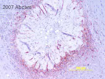 Immunohistochemistry (Formalin/PFA-fixed paraffin-embedded sections) - Anti-GFAP antibody - Astrocyte Marker (AB7260)