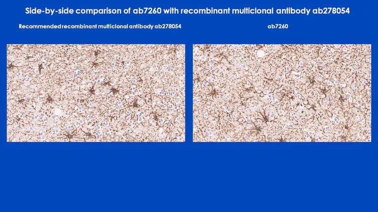 Immunohistochemistry (Formalin/PFA-fixed paraffin-embedded sections) - Anti-GFAP antibody - Astrocyte Marker (AB7260)