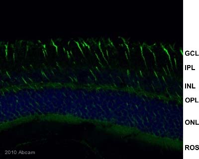 Immunohistochemistry (Formalin/PFA-fixed paraffin-embedded sections) - Anti-GFAP antibody - Astrocyte Marker (ab7260), expandable thumbnail