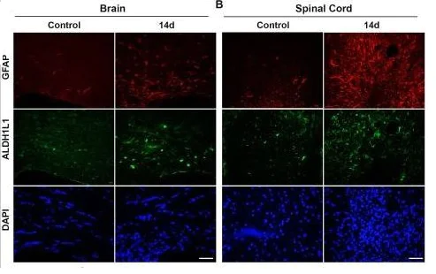 Immunohistochemistry (Formalin/PFA-fixed paraffin-embedded sections) - Anti-GFAP antibody - Astrocyte Marker (AB7260)