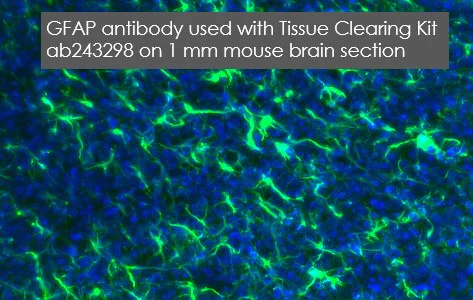 Immunohistochemistry (PFA fixed) - Anti-GFAP antibody - Astrocyte Marker (AB7260)
