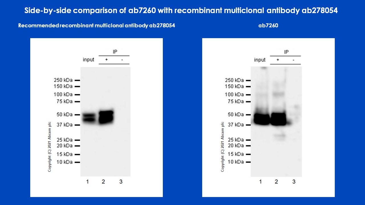 Immunoprecipitation - Anti-GFAP antibody - Astrocyte Marker (AB7260), expandable thumbnail