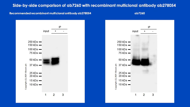 Immunoprecipitation - Anti-GFAP antibody - Astrocyte Marker (AB7260)