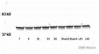Western blot - Anti-GFAP antibody - Astrocyte Marker (AB7260), expandable thumbnail