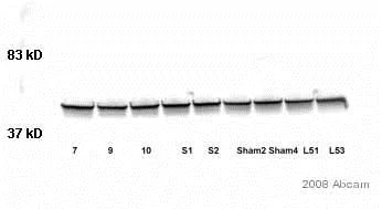 Western blot - Anti-GFAP antibody - Astrocyte Marker (AB7260)
