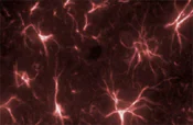 Immunocytochemistry/ Immunofluorescence - Anti-GFAP antibody - Astrocyte Marker (AB90601)