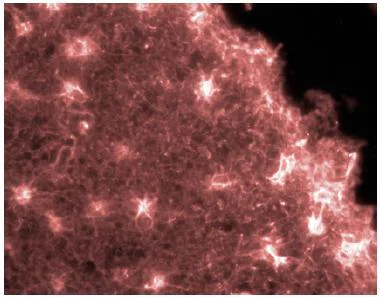 Immunocytochemistry/ Immunofluorescence - Anti-GFAP antibody - Astrocyte Marker (AB90601)