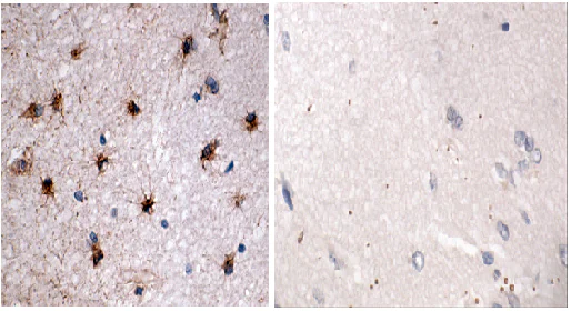 Immunohistochemistry (Formalin/PFA-fixed paraffin-embedded sections) - Anti-GFAP antibody - Astrocyte Marker (AB90601)
