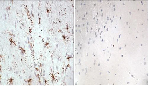 Immunohistochemistry (Formalin/PFA-fixed paraffin-embedded sections) - Anti-GFAP antibody - Astrocyte Marker (AB90601)