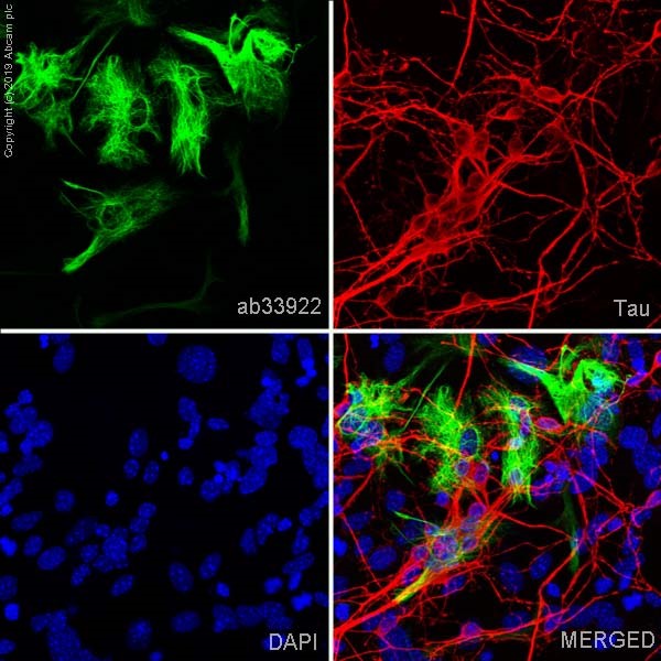 Immunocytochemistry/ Immunofluorescence - Anti-GFAP antibody [EP672Y] - Astrocyte Marker (AB33922), expandable thumbnail