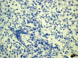 Immunohistochemistry (Formalin/PFA-fixed paraffin-embedded sections) - Anti-GFAP antibody [EP672Y] - Astrocyte Marker (AB33922)