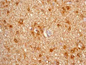 Immunohistochemistry (Formalin/PFA-fixed paraffin-embedded sections) - Anti-GFAP antibody [EP672Y] - Astrocyte Marker (AB33922)
