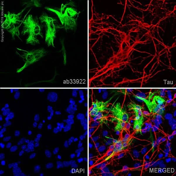 Immunocytochemistry/ Immunofluorescence - Anti-GFAP antibody [EP672Y] - BSA and Azide free (AB220820)