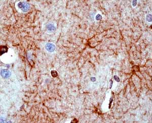 Immunohistochemistry (Formalin/PFA-fixed paraffin-embedded sections) - Anti-GFAP antibody [EP672Y] - BSA and Azide free (AB220820)