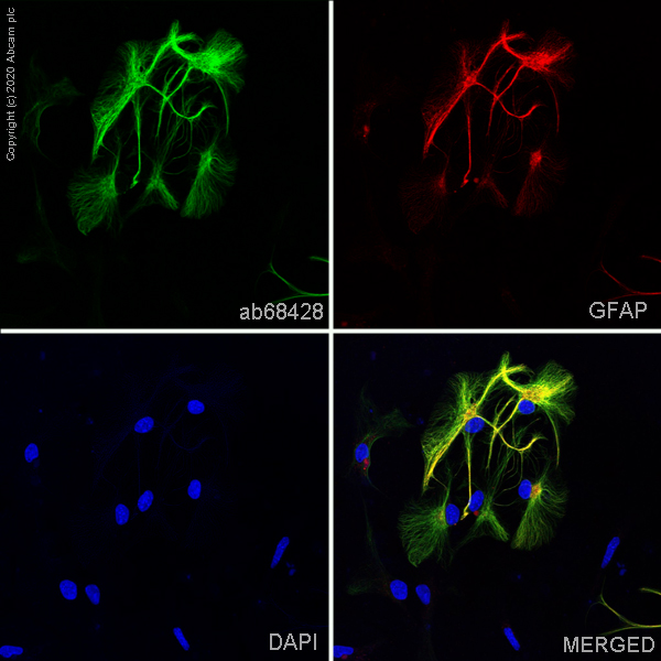 Immunocytochemistry/ Immunofluorescence - Anti-GFAP antibody [EPR1034Y] - Astrocyte Marker (AB68428), expandable thumbnail