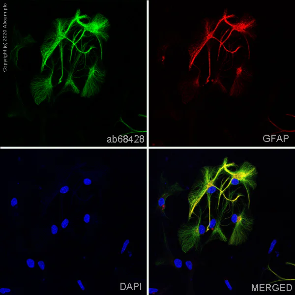Immunocytochemistry/ Immunofluorescence - Anti-GFAP antibody [EPR1034Y] - Astrocyte Marker (AB68428)