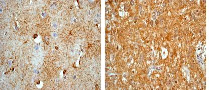 Immunohistochemistry (Formalin/PFA-fixed paraffin-embedded sections) - Anti-GFAP antibody [EPR1034Y] - Astrocyte Marker (AB68428)