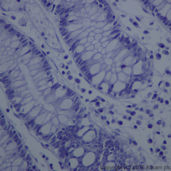 Immunohistochemistry (Formalin/PFA-fixed paraffin-embedded sections) - Anti-GFAP antibody [EPR1034Y] - Astrocyte Marker (ab68428), expandable thumbnail