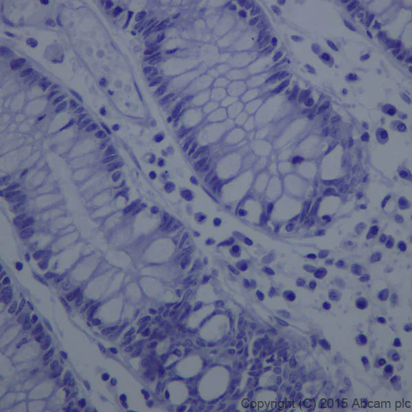 Immunohistochemistry (Formalin/PFA-fixed paraffin-embedded sections) - Anti-GFAP antibody [EPR1034Y] - Astrocyte Marker (AB68428)