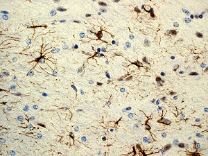 Immunohistochemistry (Formalin/PFA-fixed paraffin-embedded sections) - Anti-GFAP antibody [EPR1034Y] - Astrocyte Marker (ab68428), expandable thumbnail