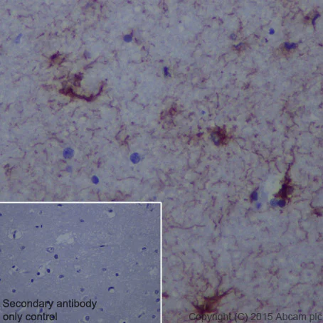Immunohistochemistry (Formalin/PFA-fixed paraffin-embedded sections) - Anti-GFAP antibody [EPR1034Y] - Astrocyte Marker (AB68428)