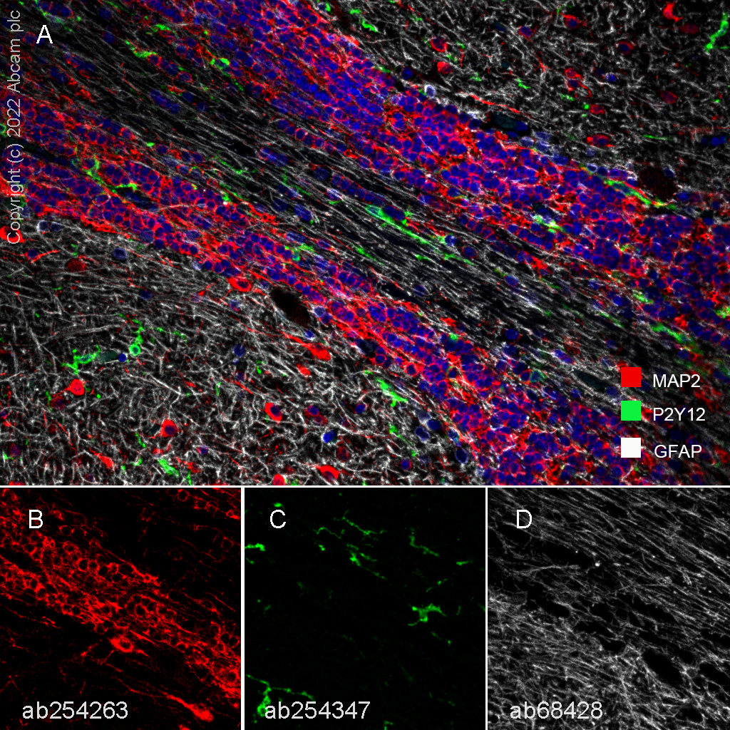 Immunohistochemistry (Formalin/PFA-fixed paraffin-embedded sections) - Anti-GFAP antibody [EPR1034Y] - Astrocyte Marker (ab68428), expandable thumbnail