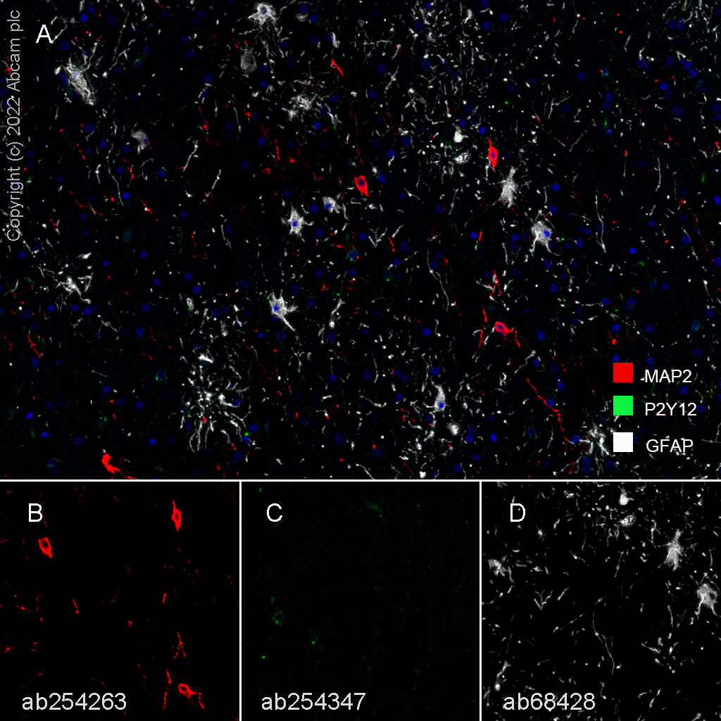 Immunohistochemistry (Formalin/PFA-fixed paraffin-embedded sections) - Anti-GFAP antibody [EPR1034Y] - Astrocyte Marker (ab68428), expandable thumbnail