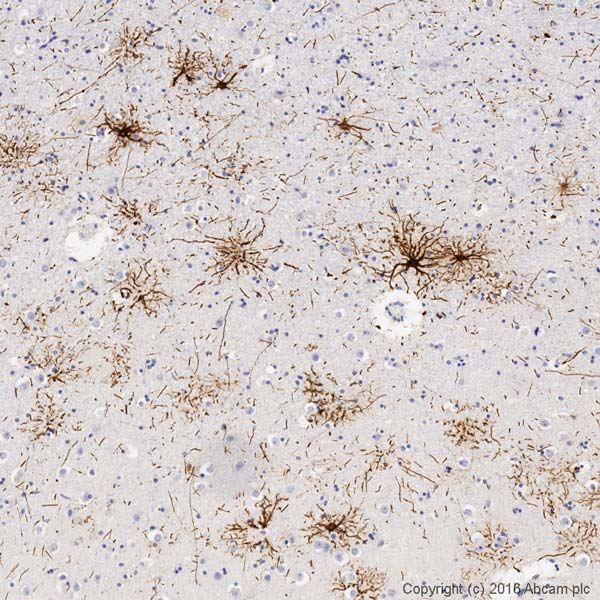 Immunohistochemistry (Formalin/PFA-fixed paraffin-embedded sections) - Anti-GFAP antibody [EPR1034Y] - Astrocyte Marker (AB68428), expandable thumbnail