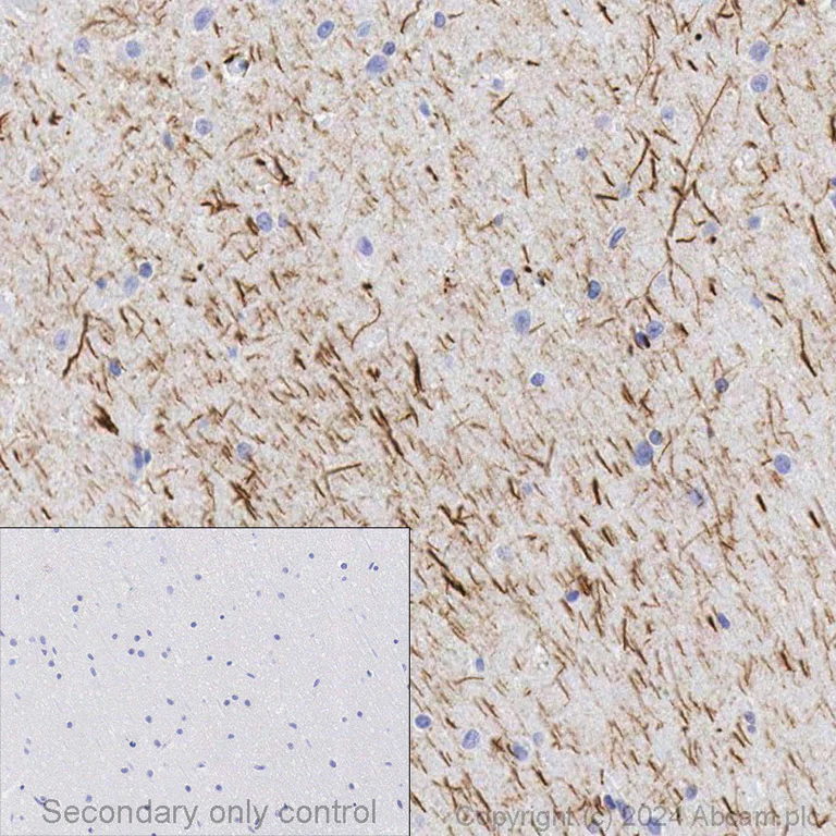 Immunohistochemistry (Formalin/PFA-fixed paraffin-embedded sections) - Anti-GFAP antibody [EPR1034Y] - Astrocyte Marker (AB68428)