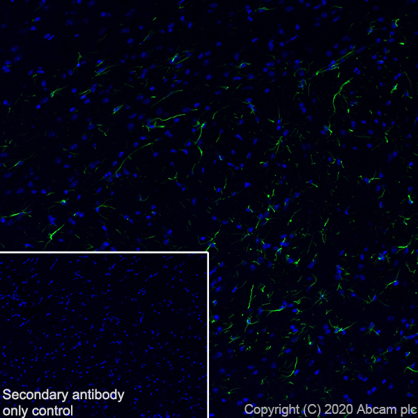 Immunohistochemistry (Frozen sections) - Anti-GFAP antibody [EPR1034Y] - Astrocyte Marker (ab68428), expandable thumbnail