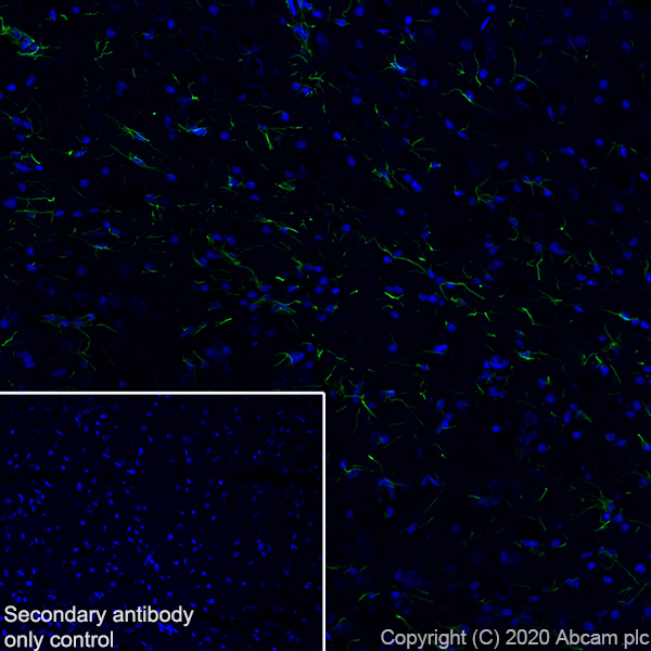 Immunohistochemistry (Frozen sections) - Anti-GFAP antibody [EPR1034Y] - Astrocyte Marker (ab68428), expandable thumbnail