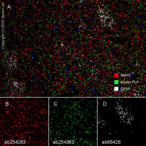 Multiplex immunohistochemistry - Anti-GFAP antibody [EPR1034Y] - Astrocyte Marker (ab68428), expandable thumbnail