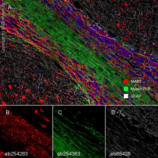 Multiplex immunohistochemistry - Anti-GFAP antibody [EPR1034Y] - Astrocyte Marker (ab68428), expandable thumbnail